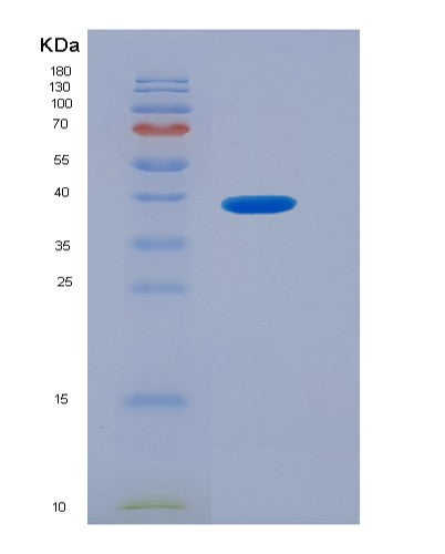SDS-PAGE analysis of Human CX3CL1 (Fractalkine) - Recombinant Protein, showing >95% purity under 15% SDS-PAGE (Reduced)