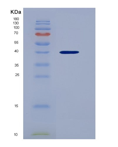 SDS-PAGE analysis of Human CXCL1 (Growth-Regulated Alpha Protein) - Recombinant Protein, showing >95% purity under 15% SDS-PAGE (Reduced)
