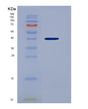 SDS-PAGE analysis of Human CXCL1 (Growth-Regulated Alpha Protein) - Recombinant Protein, showing >95% purity under 15% SDS-PAGE (Reduced)