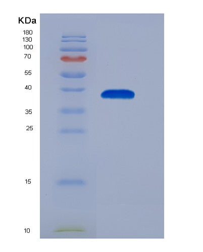 SDS-PAGE analysis of Human CXCL3 (C-X-C Motif Chemokine 3) - Recombinant Protein, showing >95% purity under 15% SDS-PAGE (Reduced)