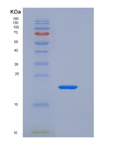 SDS-PAGE analysis of Mouse Vwf (Von Willebrand Factor) - Recombinant Protein, showing >90% purity under 15% SDS-PAGE (Reduced)
