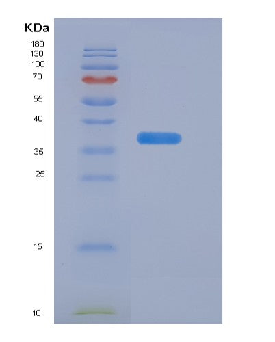 SDS-PAGE analysis of Human EGFR (Epidermal Growth Factor Receptor) - Recombinant Protein, showing >90% purity under 15% SDS-PAGE (Reduced)
