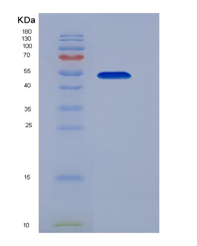 SDS-PAGE analysis of Human EPOR (Erythropoietin Receptor) - Recombinant Protein, showing >95% purity under 15% SDS-PAGE (Reduced)