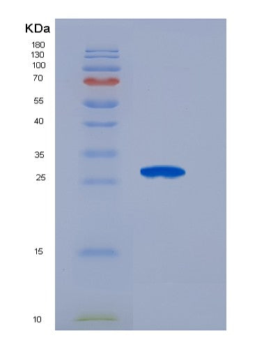 SDS-PAGE analysis of Human FGF21 (Fibroblast Growth Factor 21) - Recombinant Protein, showing >90% purity under 15% SDS-PAGE (Reduced)