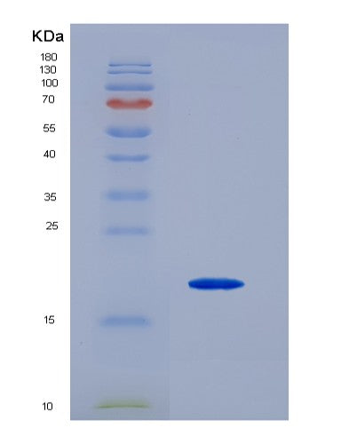 SDS-PAGE analysis of Mouse Pecam1 (Platelet Endothelial Cell Adhesion Molecule) - Recombinant Protein, showing >95% purity under 15% SDS-PAGE (Reduced)