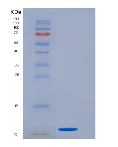SDS-PAGE analysis of Human GTF2H5 (General Transcription Factor Iih Subunit 5) - Recombinant Protein, showing >95% purity under 15% SDS-PAGE (Reduced)