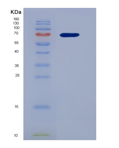 SDS-PAGE analysis of Human HGF (Hepatocyte Growth Factor) - Recombinant Protein, showing >95% purity under 15% SDS-PAGE (Reduced)