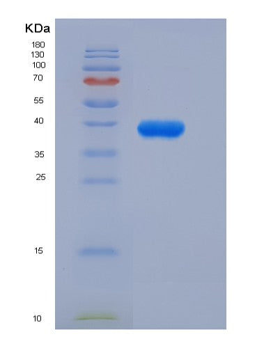 SDS-PAGE analysis of Human IGF1 (Insulin-Like Growth Factor 1) - Recombinant Protein, showing >90% purity under 15% SDS-PAGE (Reduced)