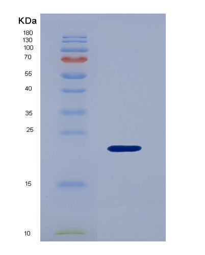 SDS-PAGE analysis of Human IGFBP3 (Insulin-Like Growth Factor-Binding Protein 3) - Recombinant Protein, showing >95% purity under 15% SDS-PAGE (Reduced)