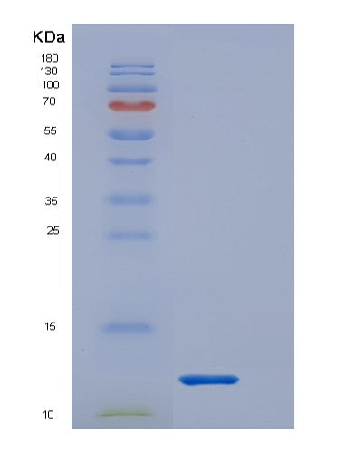 SDS-PAGE analysis of Human IL1RN (Interleukin-1 Receptor Antagonist Protein) - Recombinant Protein, showing >95% purity under 15% SDS-PAGE (Reduced)