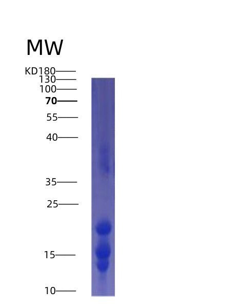 SDS-PAGE analysis of Human IL15 (Interleukin-15) - Recombinant Protein, showing >95% purity under 15% SDS-PAGE (Reduced)