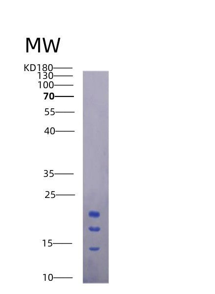 SDS-PAGE analysis of Mouse Il15 (Interleukin-15) - Recombinant Protein, showing >95% purity under 15% SDS-PAGE (Reduced)