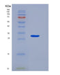 SDS-PAGE analysis of Human NGF (Beta-Nerve Growth Factor) - Recombinant Protein, showing >95% purity under 15% SDS-PAGE (Reduced)