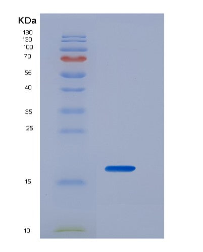 SDS-PAGE analysis of Human IL2 (Interleukin-2) - Recombinant Protein, showing >95% purity under 15% SDS-PAGE (Reduced)