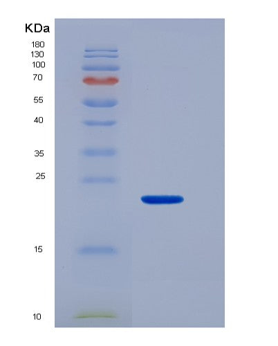 SDS-PAGE analysis of Human MUC4 (Mucin-4) - Recombinant Protein, showing >90% purity under 15% SDS-PAGE (Reduced)