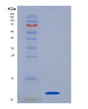 SDS-PAGE analysis of Human CXCL8 (Interleukin-8) - Recombinant Protein, showing >95% purity under 15% SDS-PAGE (Reduced)