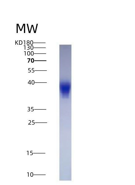 SDS-PAGE analysis of Human LIF (Leukemia Inhibitory Factor) - Recombinant Protein, showing >90% purity under 15% SDS-PAGE (Reduced)