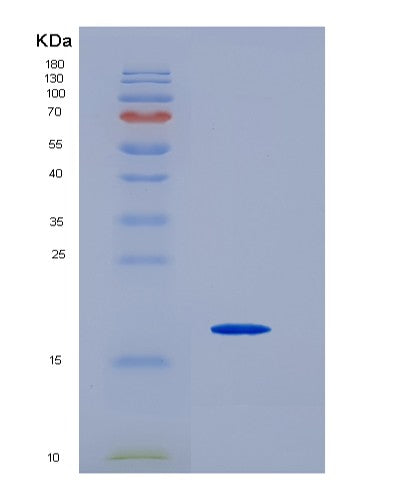 SDS-PAGE analysis of Human NUTF2 (Nuclear Transport Factor 2) - Recombinant Protein, showing >95% purity under 15% SDS-PAGE (Reduced)