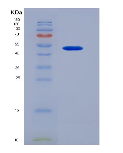SDS-PAGE analysis of Human OSM (Oncostatin-M) - Recombinant Protein, showing >90% purity under 15% SDS-PAGE (Reduced)