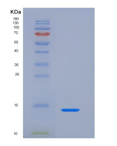 SDS-PAGE analysis of Human TFF1 (Trefoil Factor 1) - Recombinant Protein, showing >95% purity under 15% SDS-PAGE (Reduced)