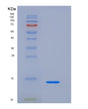 SDS-PAGE analysis of Human TFF1 (Trefoil Factor 1) - Recombinant Protein, showing >95% purity under 15% SDS-PAGE (Reduced)
