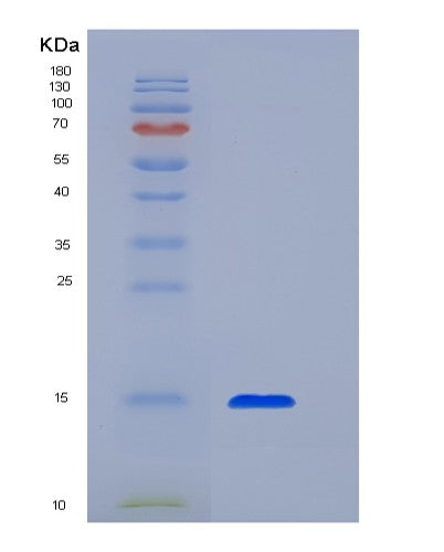 SDS-PAGE analysis of Human TGFB1 (Transforming Growth Factor Beta-1 Proprotein) - Recombinant Protein, showing >95% purity under 15% SDS-PAGE (Reduced)