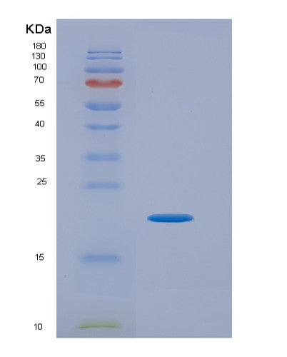 SDS-PAGE analysis of Human VEGFC (Vascular Endothelial Growth Factor C) - Recombinant Protein, showing >90% purity under 15% SDS-PAGE (Reduced)