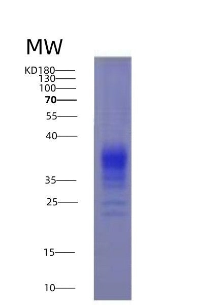 SDS-PAGE analysis of Human IFNG (Interferon Gamma) - Recombinant Protein, showing >95% purity under 15% SDS-PAGE (Reduced)