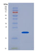 SDS-PAGE analysis of Human IL17A (Interleukin-17A) - Recombinant Protein, showing >95% purity under 15% SDS-PAGE (Reduced)