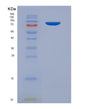 SDS-PAGE analysis of Human PECAM1 (Platelet Endothelial Cell Adhesion Molecule) - Recombinant Protein, showing >95% purity under 15% SDS-PAGE (Reduced)