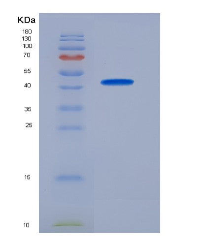 SDS-PAGE analysis of Mouse Slc5a2 (Sodium/Glucose Cotransporter 2) - Recombinant Protein, CAT# BLT-08441P showing >95% purity under 15% SDS-PAGE (Reduced)