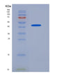 SDS-PAGE analysis of Mouse Slc5a2 (Sodium/Glucose Cotransporter 2) - Recombinant Protein, CAT# BLT-08441P showing >95% purity under 15% SDS-PAGE (Reduced)