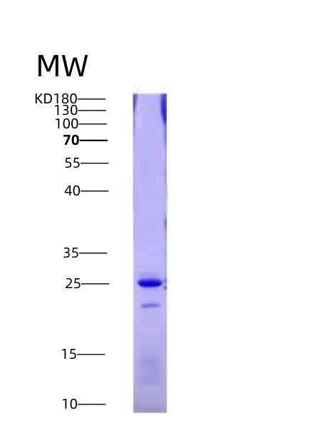 SDS-PAGE analysis of Human FAS (Tumor Necrosis Factor Receptor Superfamily Member 6) - Recombinant Protein, showing >90% purity under 15% SDS-PAGE (Reduced)