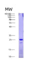 SDS-PAGE analysis of Human FAS (Tumor Necrosis Factor Receptor Superfamily Member 6) - Recombinant Protein, showing >90% purity under 15% SDS-PAGE (Reduced)