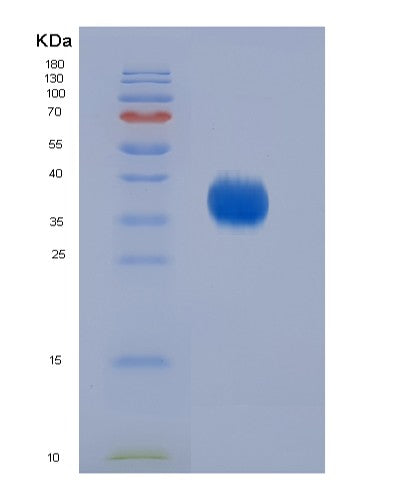 SDS-PAGE analysis of Human CD2 (T-Cell Surface Antigen Cd2) - Recombinant Protein, showing >95% purity under 15% SDS-PAGE (Reduced)