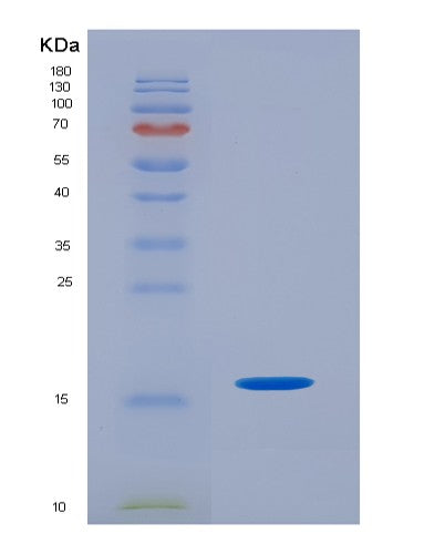 SDS-PAGE analysis of Human CD3E (T-Cell Surface Glycoprotein Cd3 Epsilon Chain) - Recombinant Protein, showing >90% purity under 15% SDS-PAGE (Reduced)
