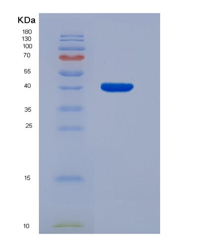 SDS-PAGE analysis of Human CD3E (T-Cell Surface Glycoprotein Cd3 Epsilon Chain) - Recombinant Protein, showing >95% purity under 15% SDS-PAGE (Reduced)
