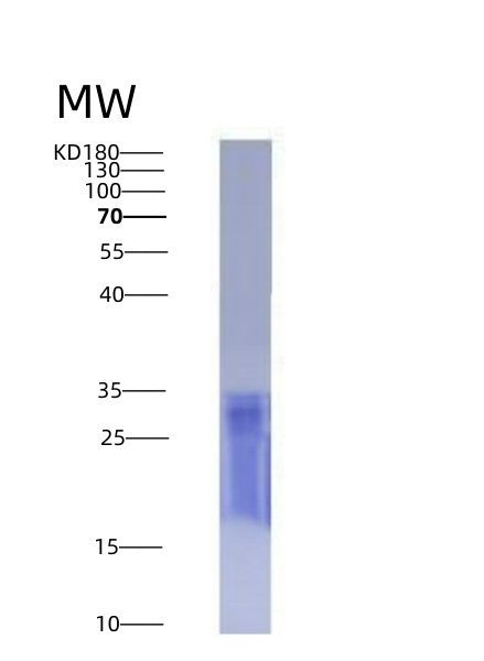 SDS-PAGE analysis of Human CD6 (T-Cell Differentiation Antigen Cd6) - Recombinant Protein, showing >90% purity under 15% SDS-PAGE (Reduced)