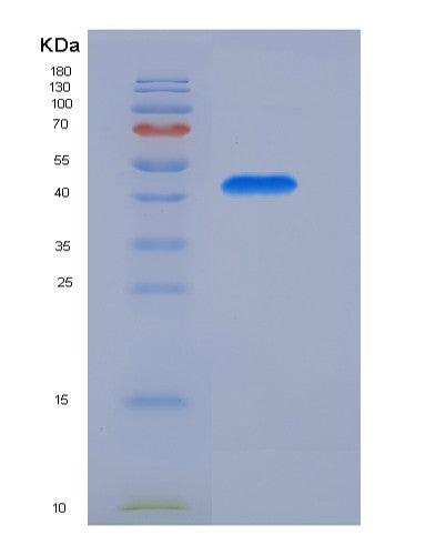 SDS-PAGE analysis of Human CD8B (T-Cell Surface Glycoprotein Cd8 Beta Chain) - Recombinant Protein, showing >90% purity under 15% SDS-PAGE (Reduced)