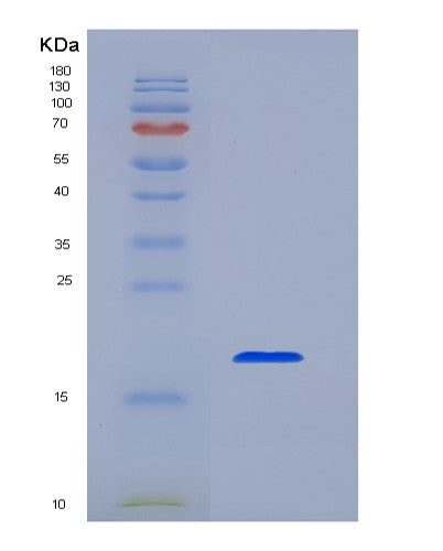 SDS-PAGE analysis of Human MS4A1 (B-Lymphocyte Antigen Cd20) - Recombinant Protein, showing >90% purity under 15% SDS-PAGE (Reduced)