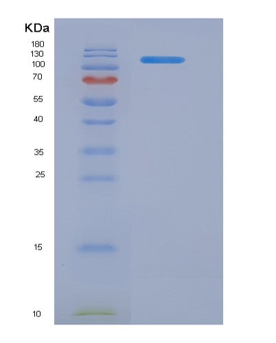 SDS-PAGE analysis of Human CD22 (B-Cell Receptor Cd22) - Recombinant Protein, showing >90% purity under 15% SDS-PAGE (Reduced)