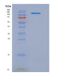 SDS-PAGE analysis of Human CD22 (B-Cell Receptor Cd22) - Recombinant Protein, showing >90% purity under 15% SDS-PAGE (Reduced)