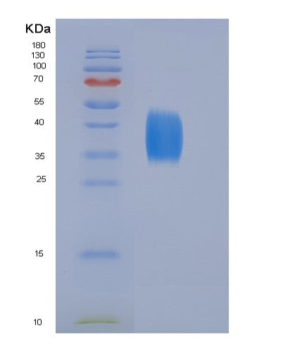 SDS-PAGE analysis of Human CD28 (T-Cell-Specific Surface Glycoprotein Cd28) - Recombinant Protein, showing >90% purity under 15% SDS-PAGE (Reduced)