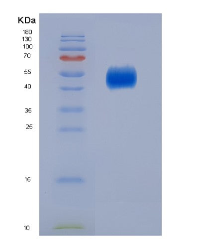 SDS-PAGE analysis of Human CD80 (T-Lymphocyte Activation Antigen Cd80) - Recombinant Protein, showing >95% purity under 15% SDS-PAGE (Reduced)