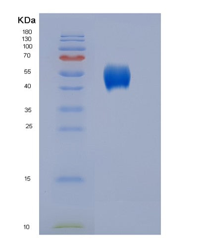 SDS-PAGE analysis of Human CD86 (T-Lymphocyte Activation Antigen Cd86) - Recombinant Protein, showing >95% purity under 15% SDS-PAGE (Reduced)