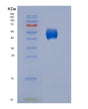 SDS-PAGE analysis of Human CD86 (T-Lymphocyte Activation Antigen Cd86) - Recombinant Protein, showing >95% purity under 15% SDS-PAGE (Reduced)