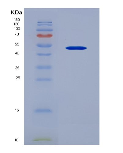 SDS-PAGE analysis of Human CD33 (Myeloid Cell Surface Antigen Cd33) - Recombinant Protein, showing >95% purity under 15% SDS-PAGE (Reduced)