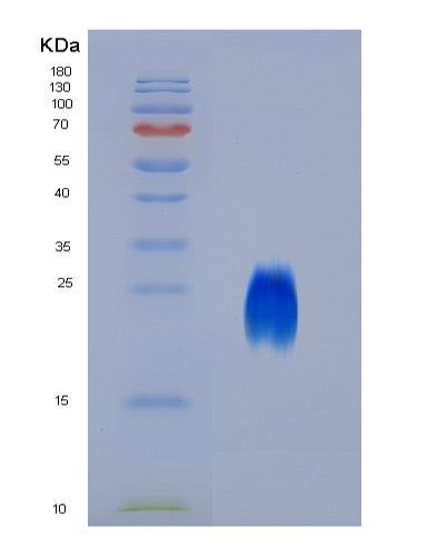 SDS-PAGE analysis of Human CD63 (Cd63 Antigen) - Recombinant Protein, showing >90% purity under 15% SDS-PAGE (Reduced)