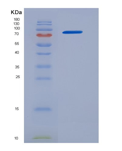SDS-PAGE analysis of Human EGFR (Epidermal Growth Factor Receptor) - Recombinant Protein, showing >95% purity under 15% SDS-PAGE (Reduced)