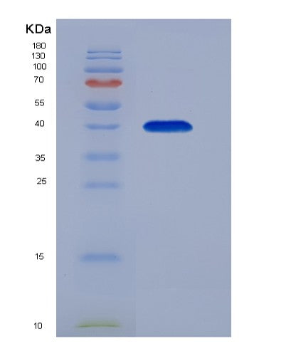 SDS-PAGE analysis of Human FCER2 (Low Affinity Immunoglobulin Epsilon Fc Receptor) - Recombinant Protein, showing >90% purity under 15% SDS-PAGE (Reduced)